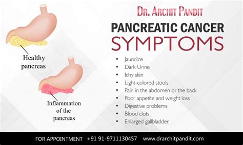 Pancreatic Cancer Yellow Stool - Update... Still getting yellow balls in stools [with ... / The ...