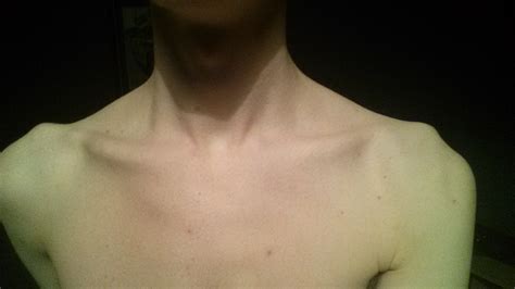 Workout to get rid of bony shoulders?