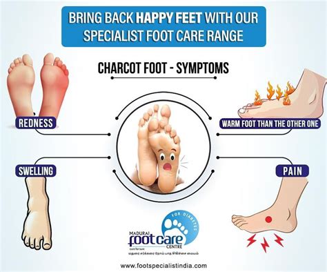 What are the causes,symptoms and treatments of Charcot foot ? | Feet care, Doctor help, Care ...