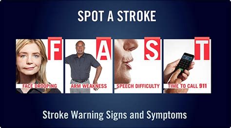 First aid for stroke symptoms - Frugal Nurse