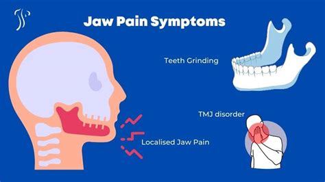 Jaw Pain Relief | TMJ Pain, Symptoms & Treatment | Dublin