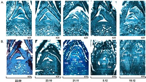 Successive microscopic views of apical buds. Successive microscopic... | Download Scientific Diagram