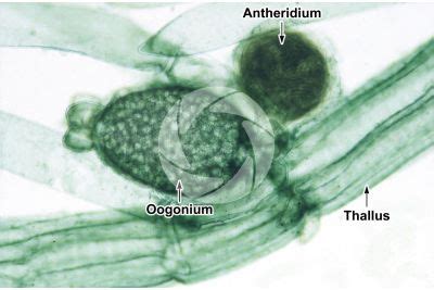 Chara foetida - Charophyta (Green algae) - Algae - Microbiology - Plant histology - Photos