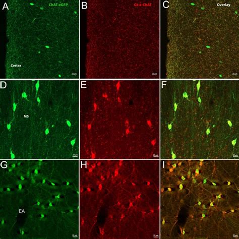 Shown are representative images of cholinergic neurons in the cortex ...