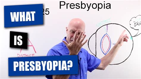 What Is Presbyopia? - YouTube