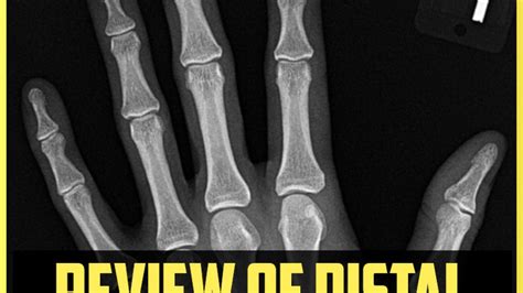 Distal Phalanx Tuft Fracture