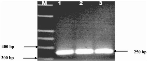 Detection of microcystin producing Microcystis spp. by amplification of ...