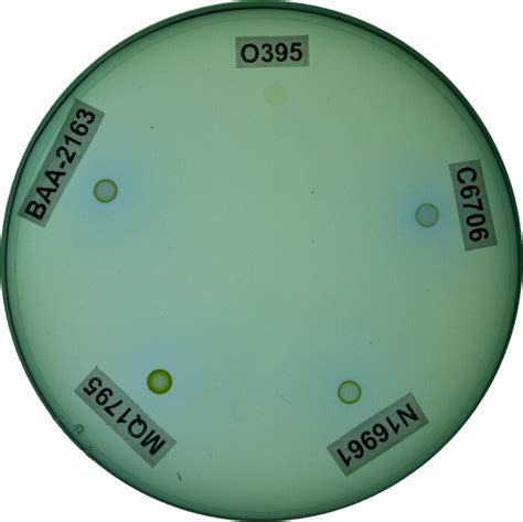 Measuring Citrate Metabolism Using Minimal Citrate Media. The ability ...