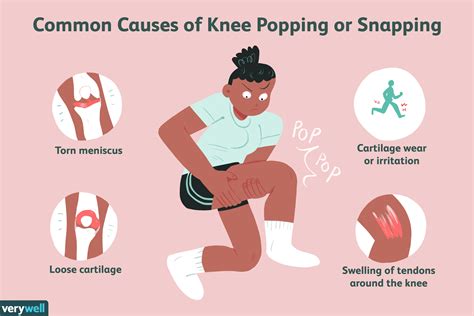 Cause and Treatment of Knee Popping or Snapping