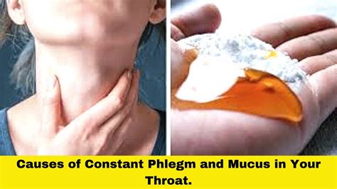 Causes of Constant Phlegm and Mucus in Your Throat || Constantly Clearing Throat of Mucus - YouTube