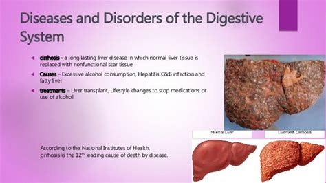 overview of the digestive system and diseases of it