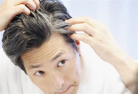 REASONS FOR PREMATURE GREYING OF HAIR - Blog | Hair O Craft | Best FUE Hair Transplant Kerala