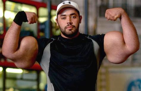 Synthol Gone Wrong (57 photos) | KLYKER.COM