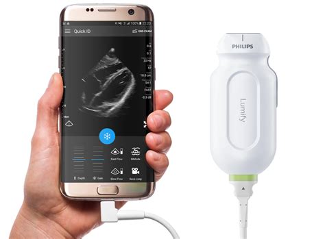 The mobile ultrasound revolution: How technology is expanding this medical tool to new frontiers ...