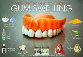 Home Remedies for an Abscessed Tooth | Top 10 Home Remedies