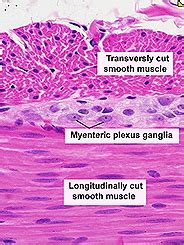 Skeletal Muscle Connective Tissue Histology - Alixlaautentica