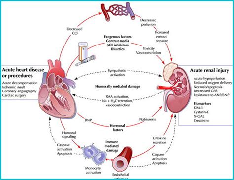 Examining the Key Symptoms and Causes of Kidney Failure | Seeking ...