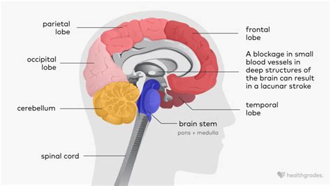 Lacunar Stroke: Symptoms, Causes, Treatments, and More