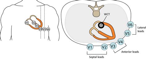 The ECG leads: electrodes, limb leads, chest (precordial) leads, 12 ...