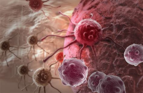 A Treatment Option in Myelofibrosis