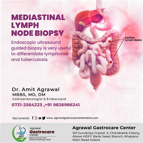 Mediastinal Lymph Node Biopsy - Agrawal Gastrocare Center Indore