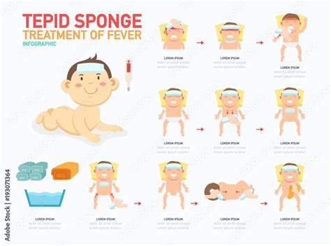 Tepid sponge.treatment of fever infographic,illustration Stock Vector ...