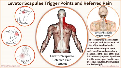 Levator Scapulae Muscle: Neck, Shoulder, Headache, Pain - The Wellness Digest