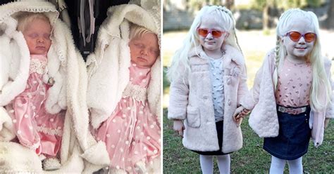 Parents Give Birth to Rare Albino Twins, Share Family Life With Their 4 ...