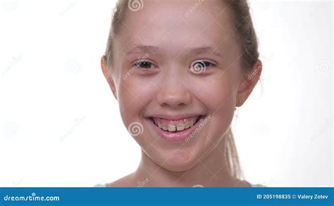 Happy Little Girl Smiling with Teeth on White Isolated Background. Bite ...