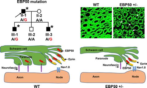Loss‐of‐function of EBP50 is a new cause of hereditary peripheral neuropathy: EBP50 functions in ...