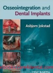 Osseointegration and Dental Implants (pdf)