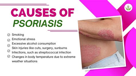 Psoriasis Unveiled: Causes, Types, Symptoms and Solutions | Care Well Medical Centre