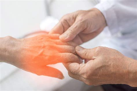 Missouri Workers Compensation Benefits for Soft Tissue Injuries