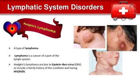 Lymphatic System Disorders