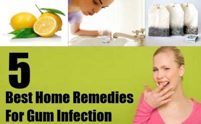5 Best Home Remedies For Gum Infection - Natural Treatment And Cure For Gum Infection | Natural ...
