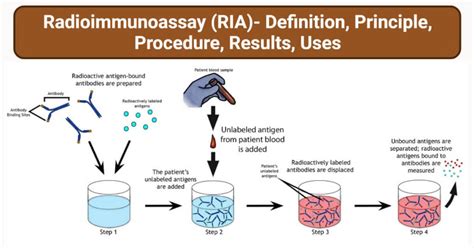 Radioimmunoassay Machine