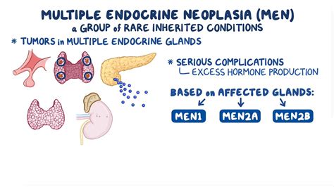 Multiple endocrine neoplasia: Clinical sciences - Osmosis Video Library