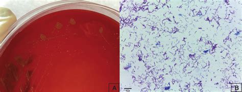 Mycobacterium smegmatis phenotypic characterization. A-Blood agar... | Download Scientific Diagram