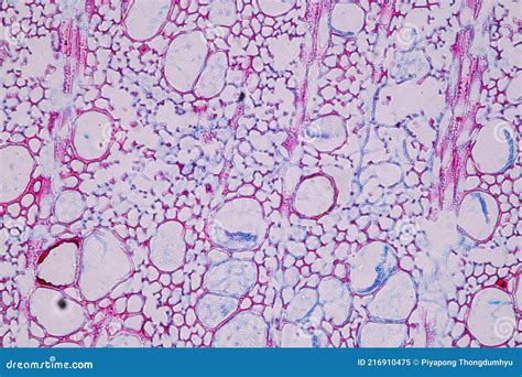 Fungi Living in Wood As a Group, are Polyphyletic Under the Microscope ...