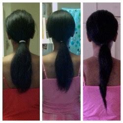 Biotin-Hair-Growth-Reviews-Biotin-Hair-Growth-Before-and-After-Pictures - eTopical