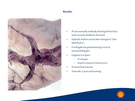 PPT - HYDRAULIC INJECTION INCIDENT A warning to us all Aberdeen ...