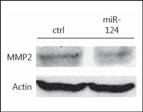 MMP2 Antibody (MA1-16641)