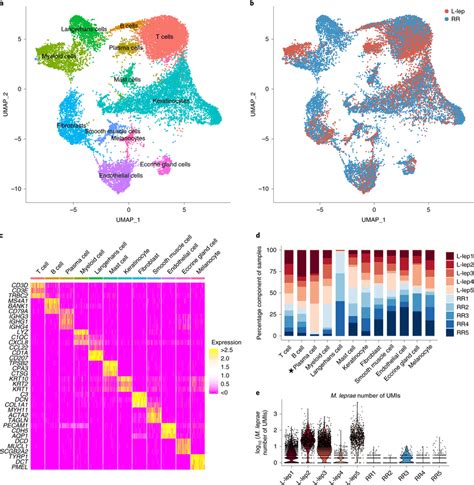 Cell types observed in leprosy lesions a, UMAP plot for 21,318 cells ...