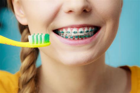 Brushing with Braces: How to Keep Your Braces Clean - Jiva Dental