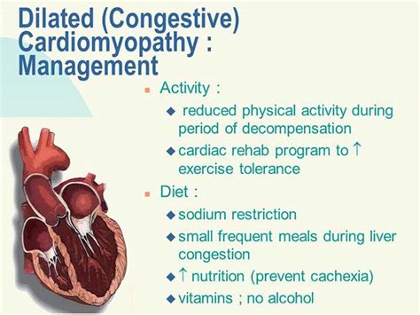 Dilated Cardiomyopathy: Causes, Complication and Prevention Tips | OnlyMyHealth