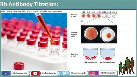 Rh Antibody Titration: Specimen, Principle, Procedure, Interpretation | Lab Tests Guide ...