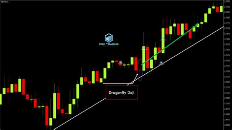 How To Trade A Doji Candlestick Like A Pro - Pro Trading School