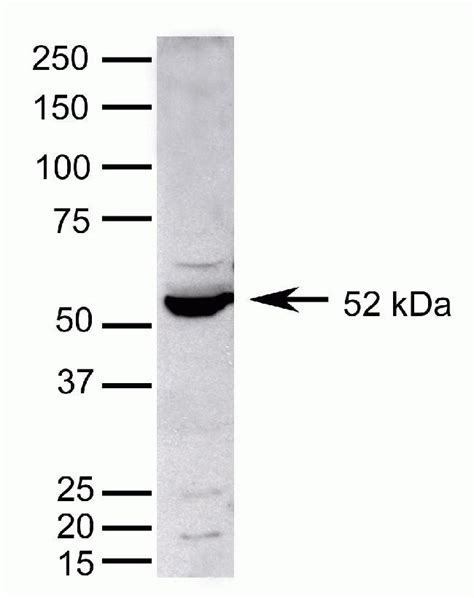 PPAR alpha Antibody (42-4600)