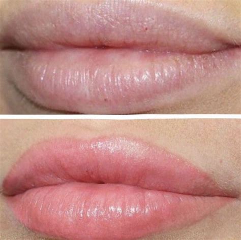 "Lip Blushing" Is the Cosmetic Procedure Everyone Will Be Talking About ...