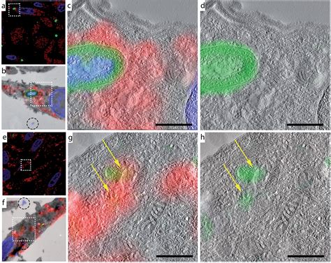 Detection of bioorthogonal groups by correlative light and electron microscopy allows imaging of ...